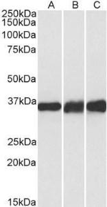 Anti-LDHB antibody