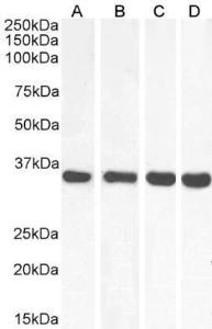 Anti-MDH2 Antibody (A85259) (001 µg/ml) staining of Human (A), Mouse (B), Rat (C) and Pig (D) Heart lysate (35 µg protein in RIPA buffer) Primary incubation was 1 hour Detected by chemiluminescence