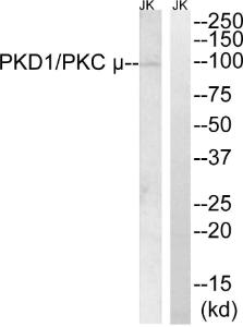 Western blot analysis of lysates from Jurkat cells using Anti-PKC mu Antibody The right hand lane represents a negative control, where the antibody is blocked by the immunising peptide