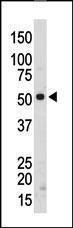 Anti-SRMS Rabbit Polyclonal Antibody (FITC (Fluorescein))