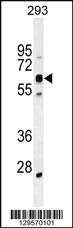 Anti-KRBA2 Rabbit Polyclonal Antibody [clone: 277CT1]