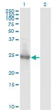 Anti-KIRREL2 Mouse Monoclonal Antibody [clone: 2B9-1D3]