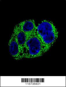 Anti-AMACR Rabbit Polyclonal Antibody (FITC (Fluorescein Isothiocyanate))