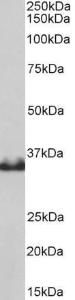 Anti-LDHB antibody