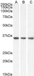 Anti-MDH2 Antibody (A85259) (01 µg/ml) staining of HeLa (A), HepG2 (B) and NIH3T3 (C) lysate (35 µg protein in RIPA buffer) Primary incubation was 1 hour Detected by chemiluminescence