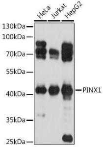 Western blot analysis of extracts of various cell lines, using Anti-PINX1 / LPTS Antibody (A93294) at 1:1,000 dilution. The secondary antibody was Goat Anti-Rabbit IgG H&L Antibody (HRP) at 1:10,000 dilution.