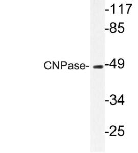 Western blot analysis of lysate from HUVEC cells using Anti-CNPase Antibody