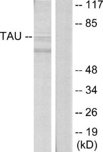 Western blot analysis of lysates from HeLa cells using Anti-Tau Antibody. The right hand lane represents a negative control, where the antibody is blocked by the immunising peptide