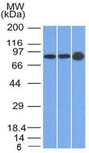 Anti-Plakophilin 1 Mouse Monoclonal Antibody [clone: 10B2]