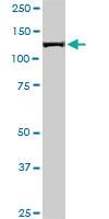 Anti-CAND1 Mouse Monoclonal Antibody [clone: 1G5]