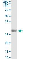 Anti-KIRREL2 Mouse Monoclonal Antibody [clone: 2B9-1D3]