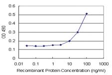 Anti-AHI1 Polyclonal Antibody Pair