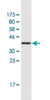 Anti-KMT2D Mouse Monoclonal Antibody [clone: 2E1]