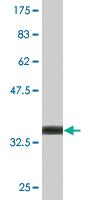 Anti-BLMH Mouse Monoclonal Antibody [clone: 4A2]