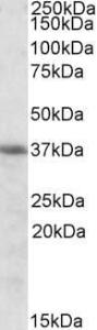 Antibody anti-HMOX2 100 µg