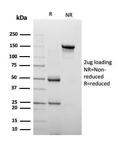 SDS-PAGE analysis of Anti-Chromogranin A Antibody [CHGA/4223] under non-reduced and reduced conditions; showing intact IgG and intact heavy and light chains, respectively. SDS-PAGE analysis confirms the integrity and purity of the antibody