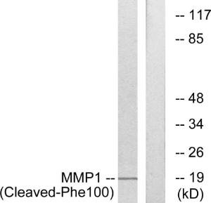 Western blot analysis of lysates from A549 cells, treated with etoposide 25uM 24h using Anti-MMP1 (cleaved Phe100) Antibody. The right hand lane represents a negative control, where the antibody is blocked by the immunising peptide.