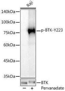 Western blot analysis of extracts of Raji cells, using Anti-BTK (phospho Tyr223) Antibody [ARC0307] (A305366) at 1:500 dilution