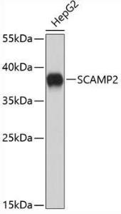 Western blot analysis of extracts of HepG2 cells, using Anti-SCAMP2/SC2 Antibody (A9447) The secondary antibody was Goat Anti-Rabbit IgG H&L Antibody (HRP) at 1:10,000 dilution Lysates/proteins were present at 25 µg per lane