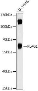 Western blot analysis of extracts of U-87MG cells, using Anti-PLAG1 Antibody (A93295) at 1:1,000 dilution. The secondary antibody was Goat Anti-Rabbit IgG H&L Antibody (HRP) at 1:10,000 dilution.