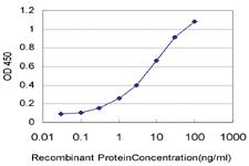 Anti-NKX3-1 Mouse Monoclonal Antibody [clone: 1C7]