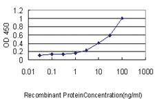 Anti-KIRREL2 Mouse Monoclonal Antibody [clone: 2B9-1D3]