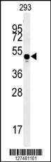 Anti-MYLK4 Rabbit Polyclonal Antibody (AP (Alkaline Phosphatase))