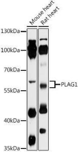 Western blot analysis of extracts of various cell lines, using Anti-PLAG1 Antibody (A93295) at 1:1,000 dilution. The secondary antibody was Goat Anti-Rabbit IgG H&L Antibody (HRP) at 1:10,000 dilution.