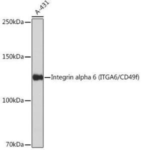 Western blot analysis of extracts of A-431 cells, using Anti-Integrin alpha 6 Antibody [ARC51523] (A306270) at 1:1000 dilution. The secondary Antibody was Goat Anti-Rabbit IgG H&L Antibody (HRP) at 1:10000 dilution. Lysates/proteins were present at 25 µg per lane