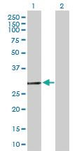 Anti-GCH1 Mouse Polyclonal Antibody