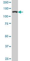 Anti-CAND1 Mouse Monoclonal Antibody [clone: 1G5]