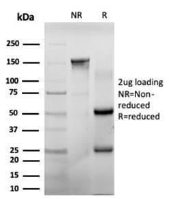 Antibody anti-CHEK2 pcrp-CHEK2-1A4 100 µg