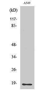 Western blot analysis of various cells using Anti-MMP1 (cleaved Phe100) Antibody