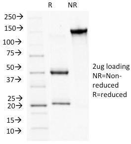 Anti-Plakophilin 1 Mouse Monoclonal Antibody [clone: 10B2]