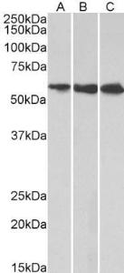 Anti-HMGCS1 Antibody (A83613) (1 µg/ml) staining of HeLa (A), HepG2 (B) and K562 (C) lysates (35 µg protein in RIPA buffer). Primary incubation was 1 hour. Detected by chemiluminescence