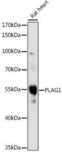 Western blot analysis of extracts of Rat heart, using Anti-PLAG1 Antibody (A93296) at 1:1000 dilution. The secondary Antibody was Goat Anti-Rabbit IgG H&L Antibody (HRP) at 1:10000 dilution. Lysates/proteins were present at 25 µg per lane