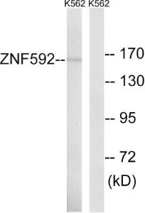 Western blot analysis of lysates from K562 cells using Anti-ZNF592 Antibody. The right hand lane represents a negative control, where the antibody is blocked by the immunising peptide.