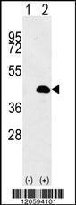 Anti-LUC7L Rabbit Polyclonal Antibody (APC (Allophycocyanin))