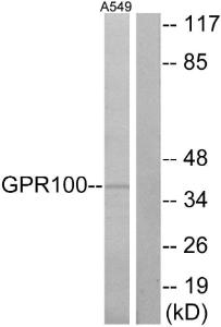 Anti-GPCR GPR100 Rabbit Polyclonal Antibody