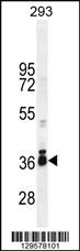 Anti-STRA8 Rabbit Polyclonal Antibody [clone: 318CT41.3.2]