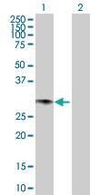 Anti-GCH1 Rabbit Polyclonal Antibody