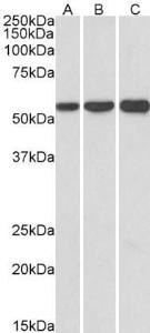 Anti-HMGCS1 Antibody (A83614) (1µg/ml) staining of HeLa (A), HepG2 (B) and K562 (C) lysates (35µg protein in RIPA buffer). Primary incubation was 1 hour. Detected by chemiluminescence.