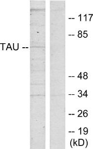 Anti-Tau 13 Rabbit Polyclonal Antibody