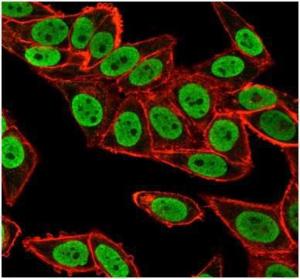 Antibody anti-CHEK2 pcrp-CHEK2-1A4 100 µg