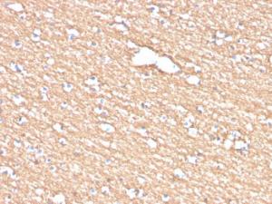 Immunohistochemical analysis of formalin-fixed, paraffin-embedded human brain using Anti-Myelin PLP Antibody [PLP1/4259]