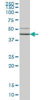 Anti-HORMAD1 Mouse Monoclonal Antibody [clone: 2E5]