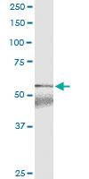 Anti-ABCC11 Polyclonal Antibody Pair