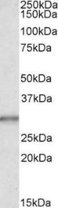 Anti-CA1 Antibody (A83615) (0.03µg/ml) staining of Human Liver lysate (35µg protein in RIPA buffer). Primary incubation was 1 hour. Detected by chemiluminescence.