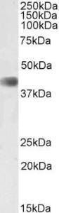 Anti-CDK9 Antibody (A85262) (2 µg/ml) staining of Mouse Skeletal Muscle lysate (35 µg protein in RIPA buffer). Primary incubation was 1 hour. Detected by chemiluminescence