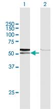 Anti-AMY1C Rabbit Polyclonal Antibody